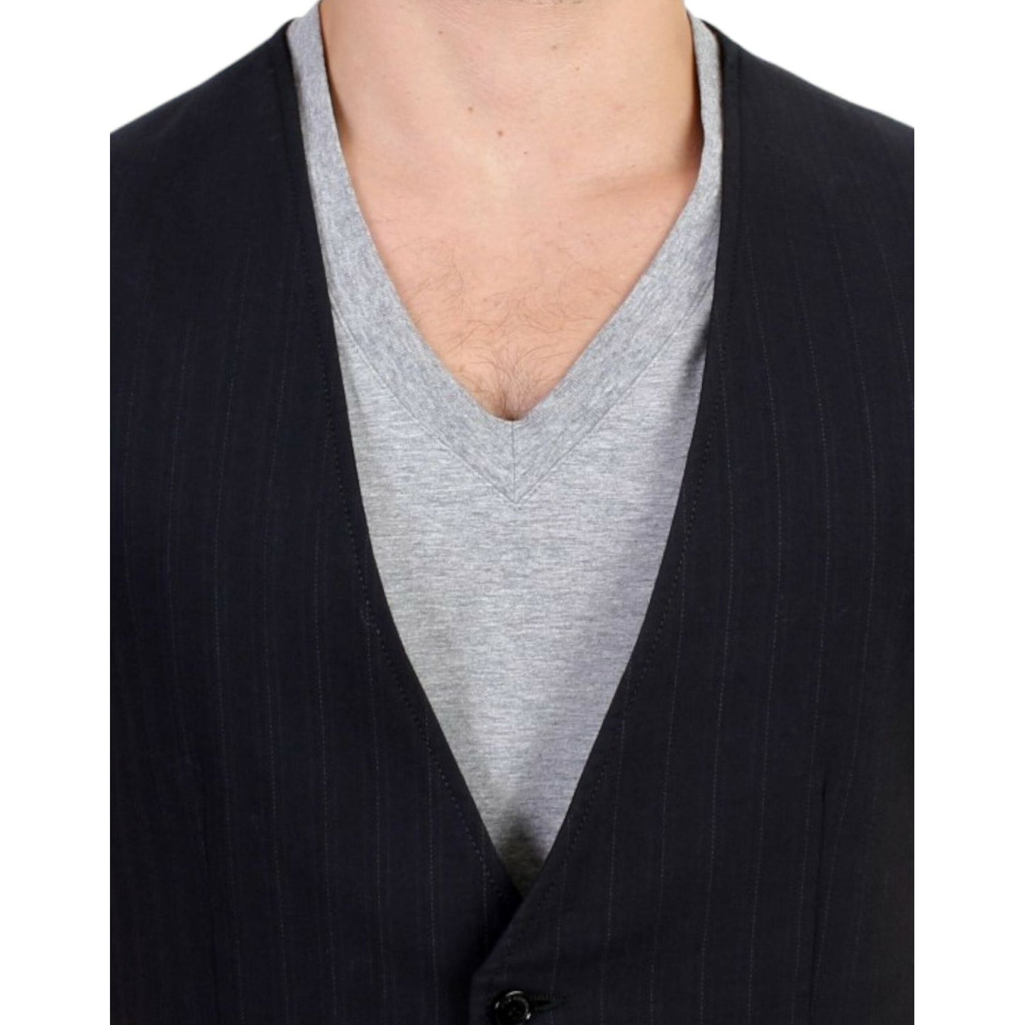 Costume National Elegant Striped Casual Vest - Cotton Blend Costume National Black